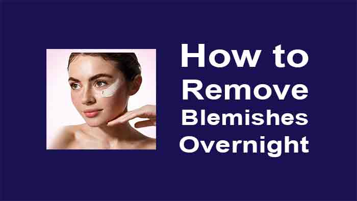 How to Remove Blemishes Overnight